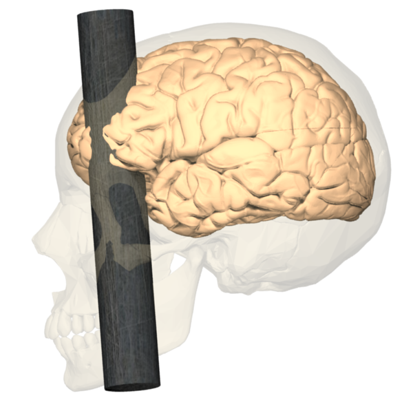 Learning about Brain Science from Phineas Gage